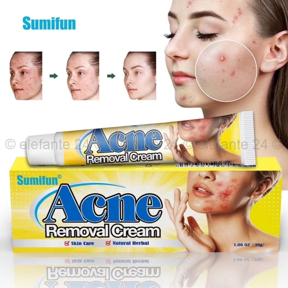 کرم‌ضدجوش