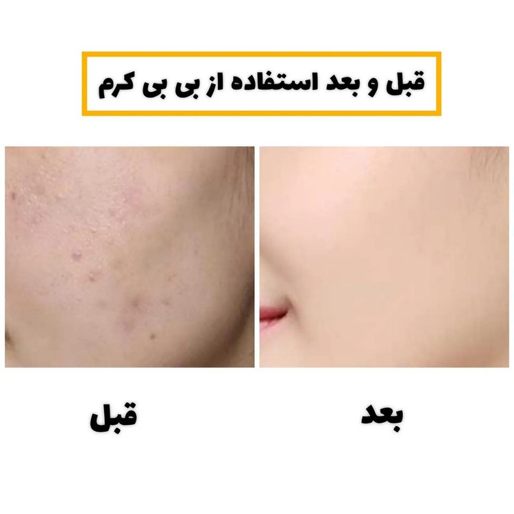 کوشن بی بی کرم کاوربالا