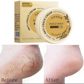 درمان ترک پوست