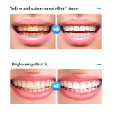 سفیدکننده دندان بی ضررسادور