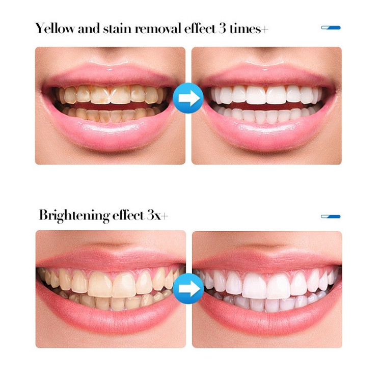 سفیدکننده دندان بی ضررسادور