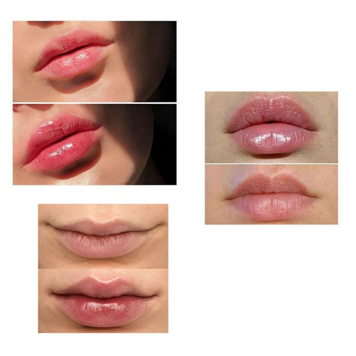 مشخصات قیمت وخریدحجم دهنده لب فلفلی