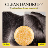 مشخصات وسفارش شامپوضدشوره