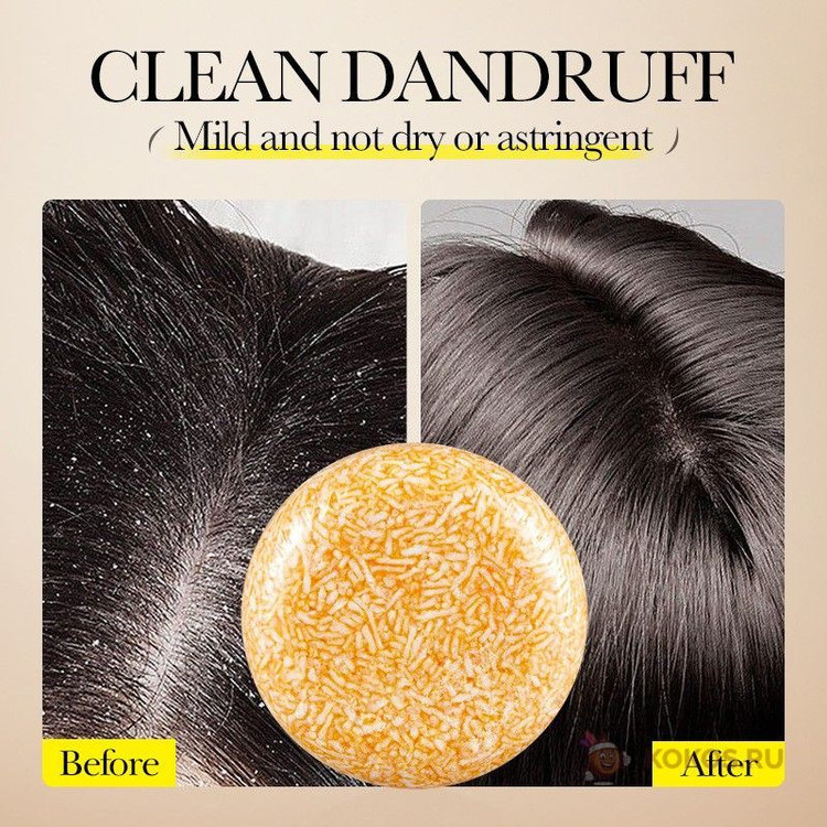 مشخصات وسفارش شامپوضدشوره