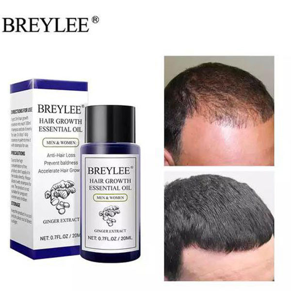 مشخصات قیمت وخریدروغن رشد و تقویت مو عصاره زنجبیل بریلی