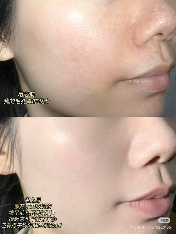 پرایمرکاریته