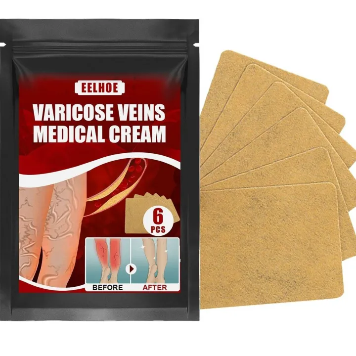 مشخصات وخریدچسب درمان کننده واریس