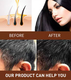 شامپوی درمان سفیدی مو