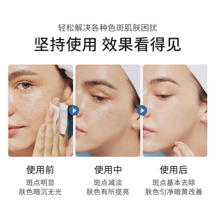 سرم ضدلک حاملگی