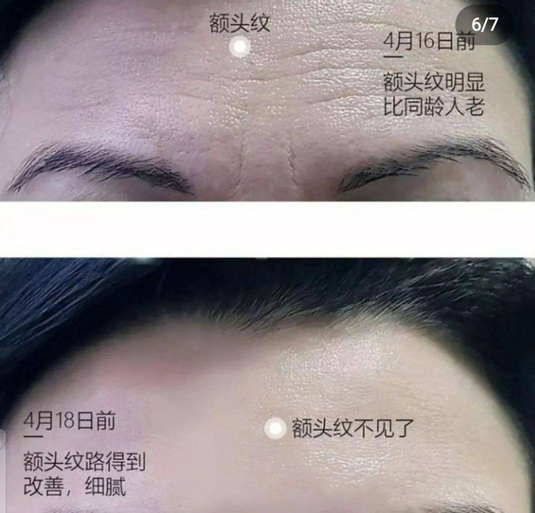 خریدماسک ورقه ای ضدچروک پیشانی